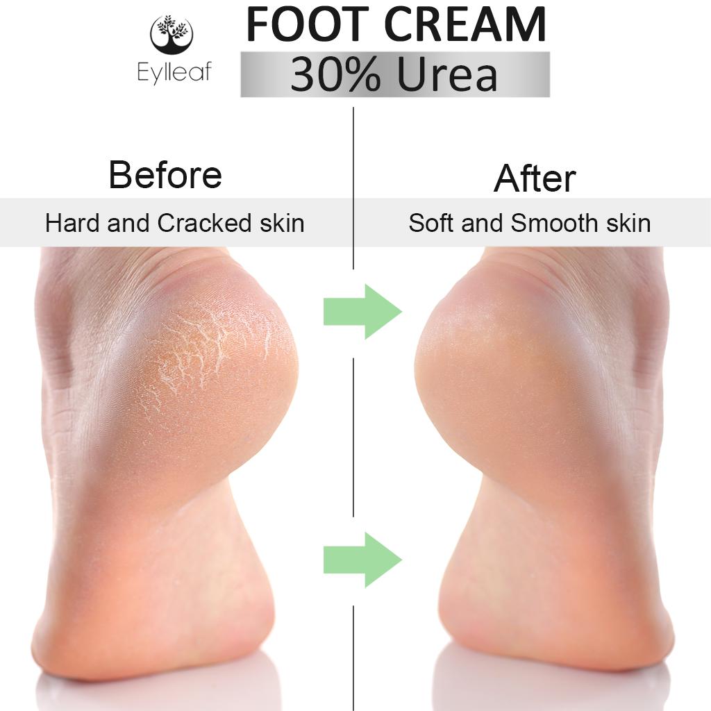 Foot Cream 30 urea 4